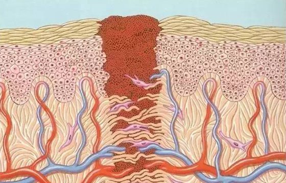 為什么傷口愈合時會感覺癢,傷口愈合特別癢怎么辦