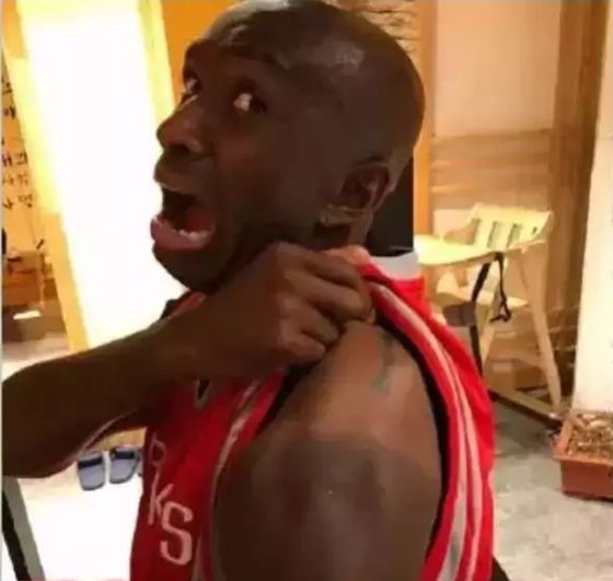 人為什么會(huì)被曬黑,曬黑后怎么變白